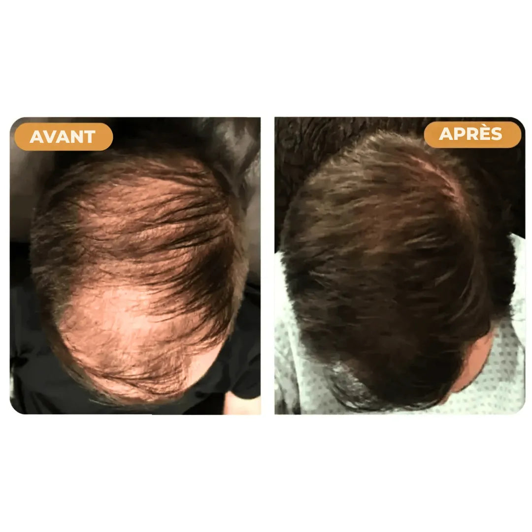 (FR) Hairzen Hair Root Shampoo