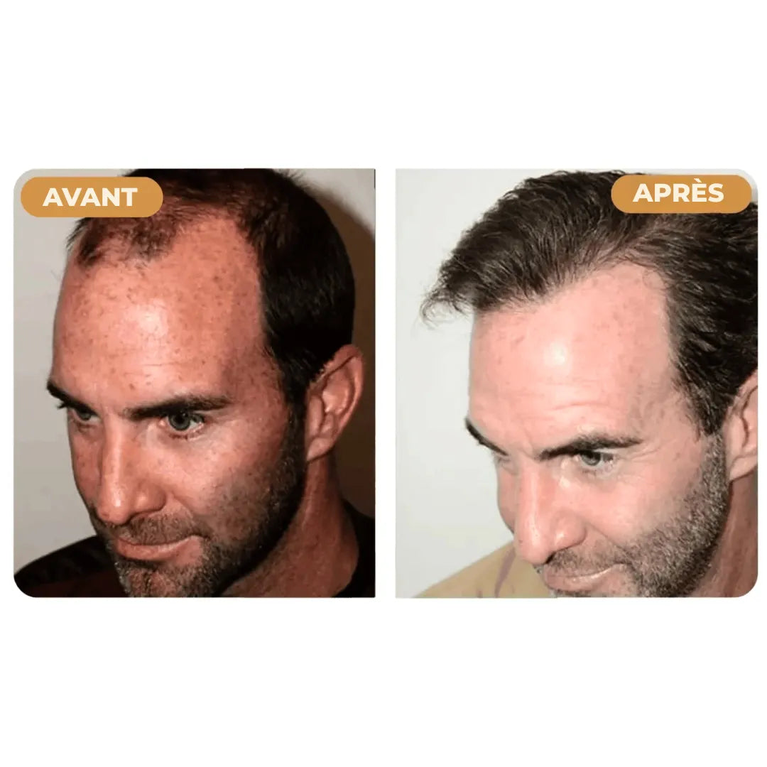 (FR) Hairzen Hair Root Shampoo
